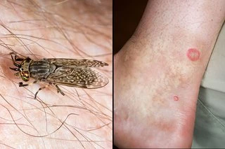 horsefly